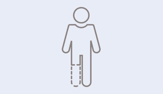 Un symbole montrant une personne avec une jambe amputée.
